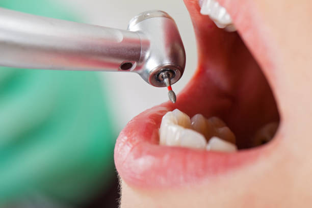 Best Orthodontic Emergency Dentist in Moroni, UT